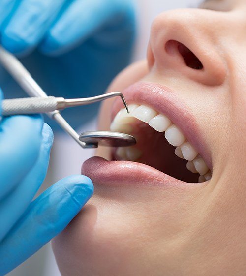 Periodontal Therapy North Grafton Ma Gum Disease Oral Health